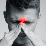 Scottish Medicines Consortium approves Dupilumab for eligible NHS Scotland patients with chronic rhinosinusitis with nasal polyps (CRSwNP)